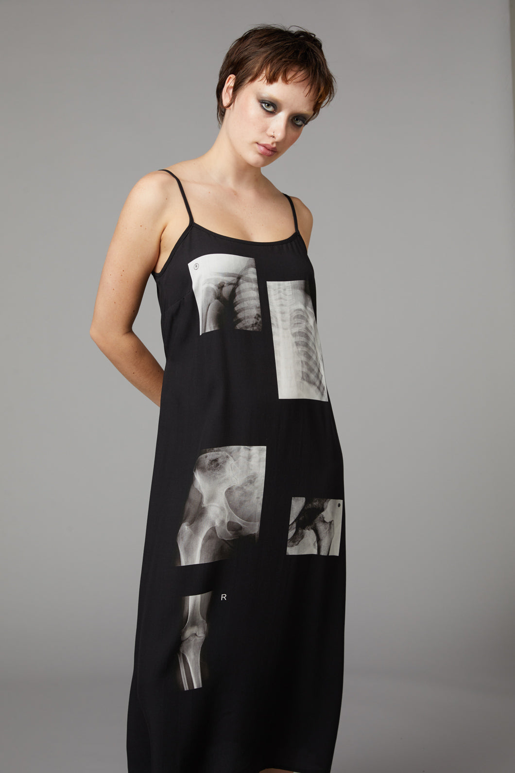 Black Friday - X-Ray Print Dress - black