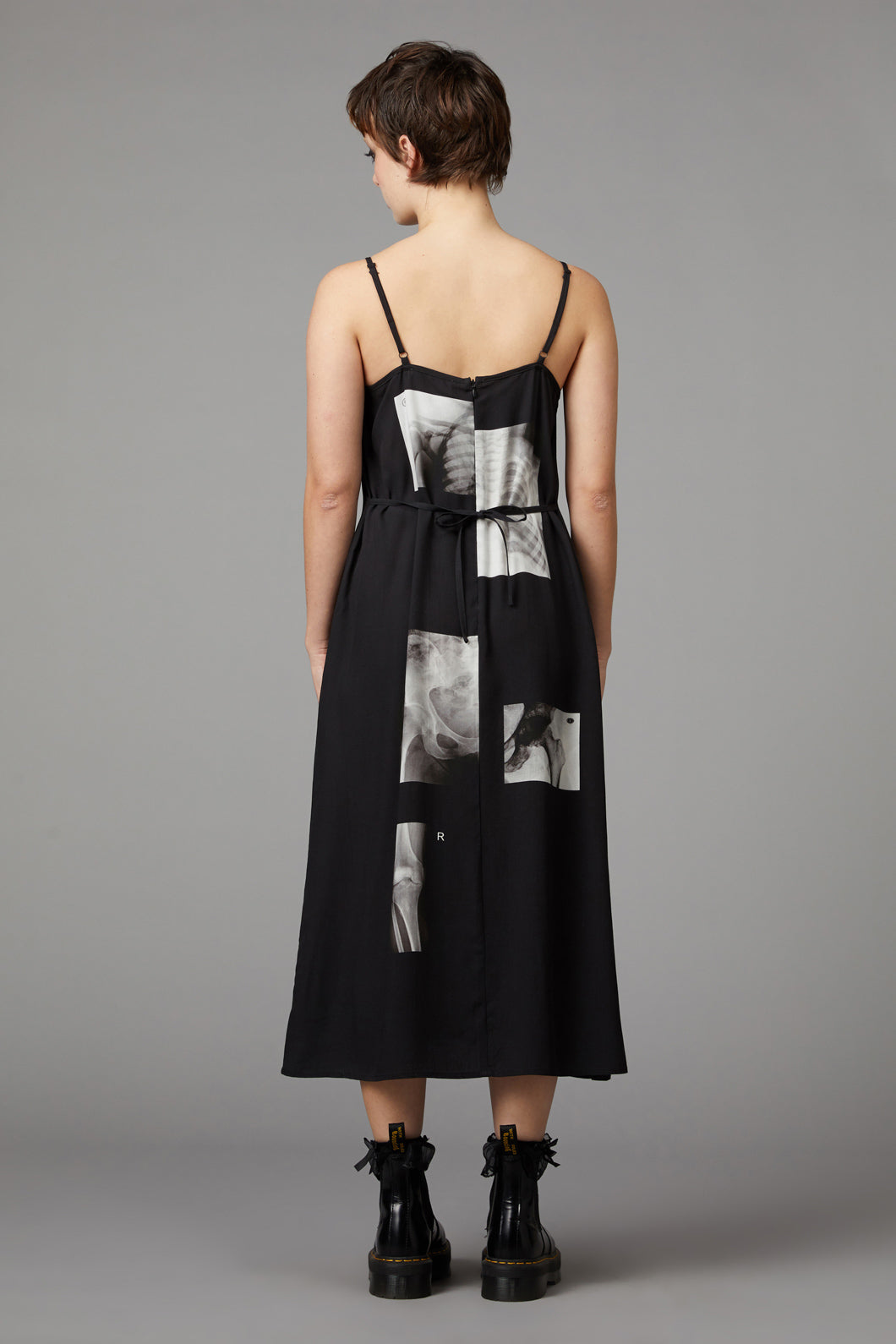Black Friday - X-Ray Print Dress - black