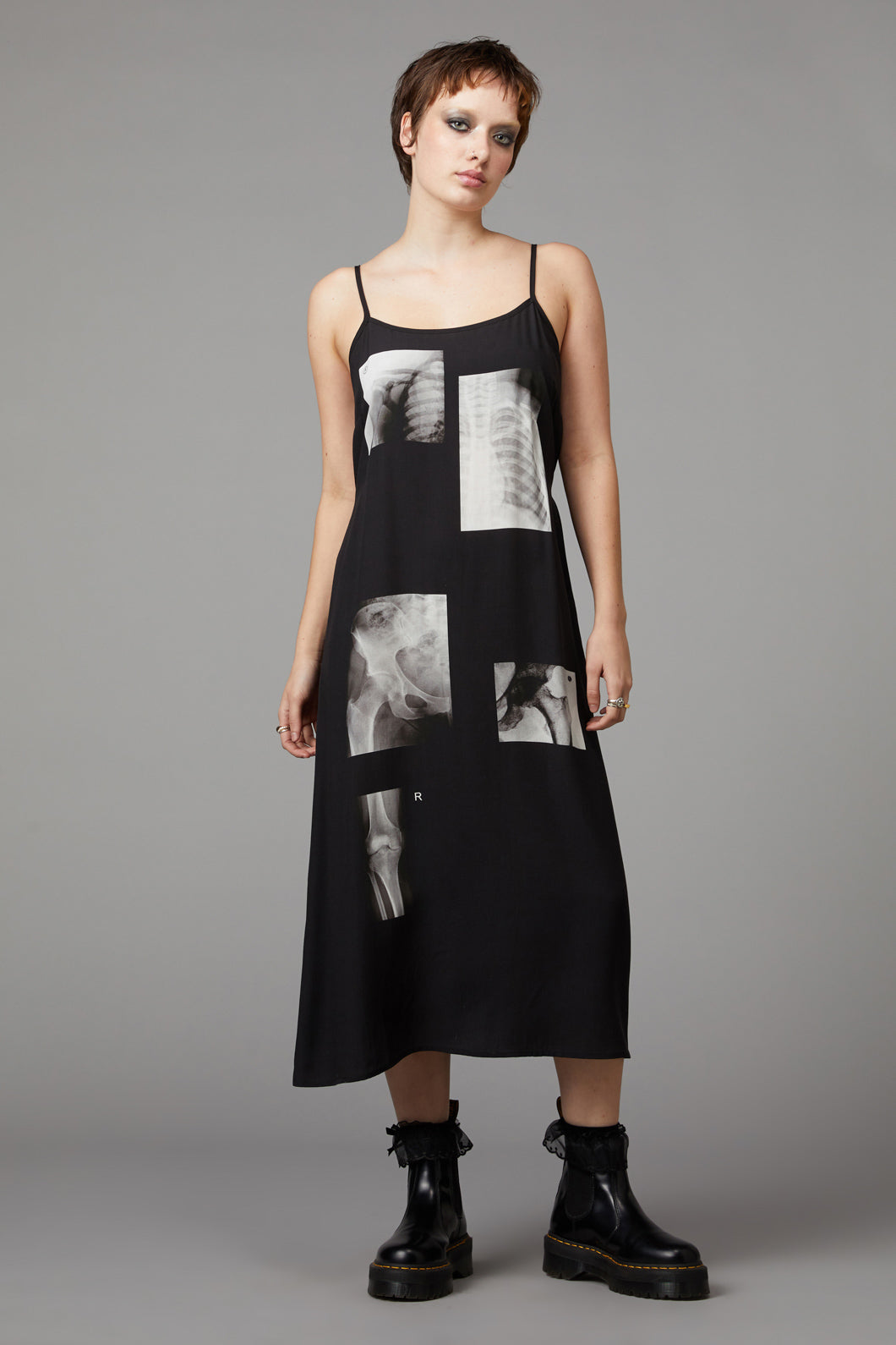 Black Friday - X-Ray Print Dress - black